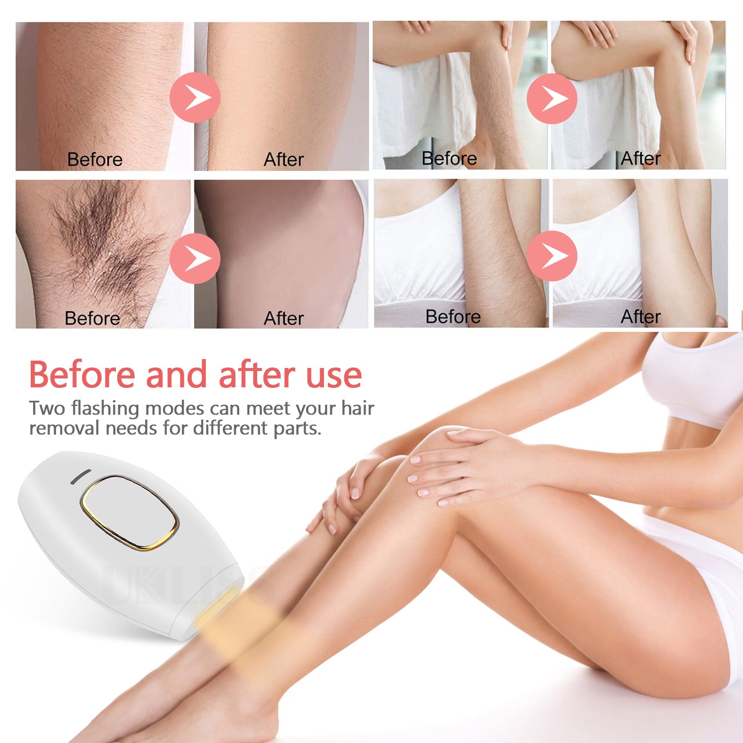 Hair Removal IPL Epilator