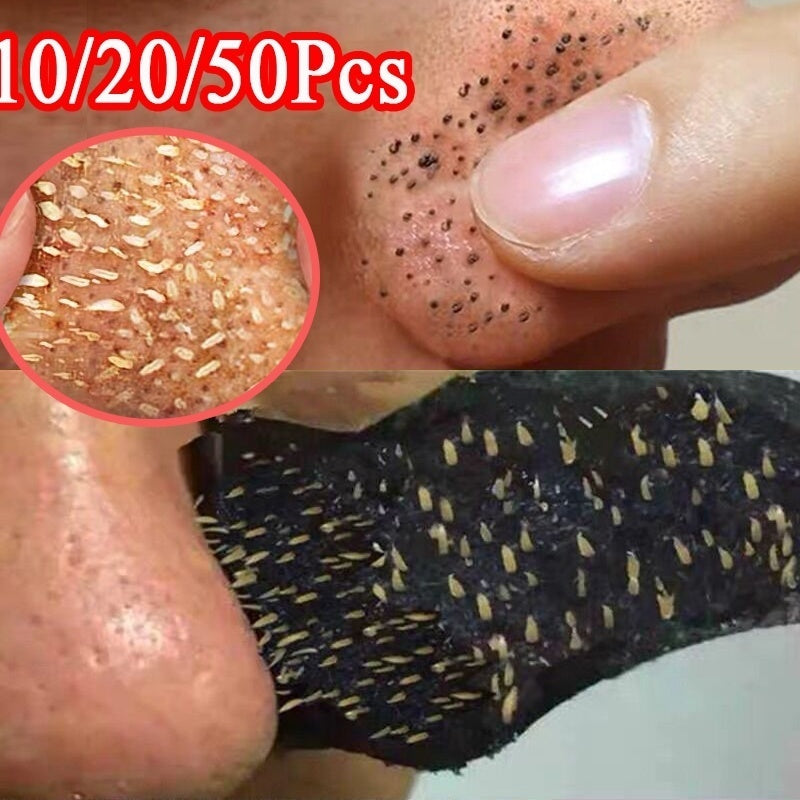 Blackhead Remover Nose Sticker Acne Treatment Mask Nose Sticker 5-60pc