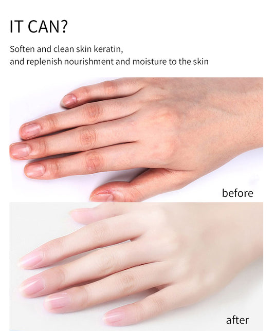 Thai yellow peeling oil bleaching Dark skin retinol with peptide Spots Blackheads Blemishes Bad Skin Spot Treatment